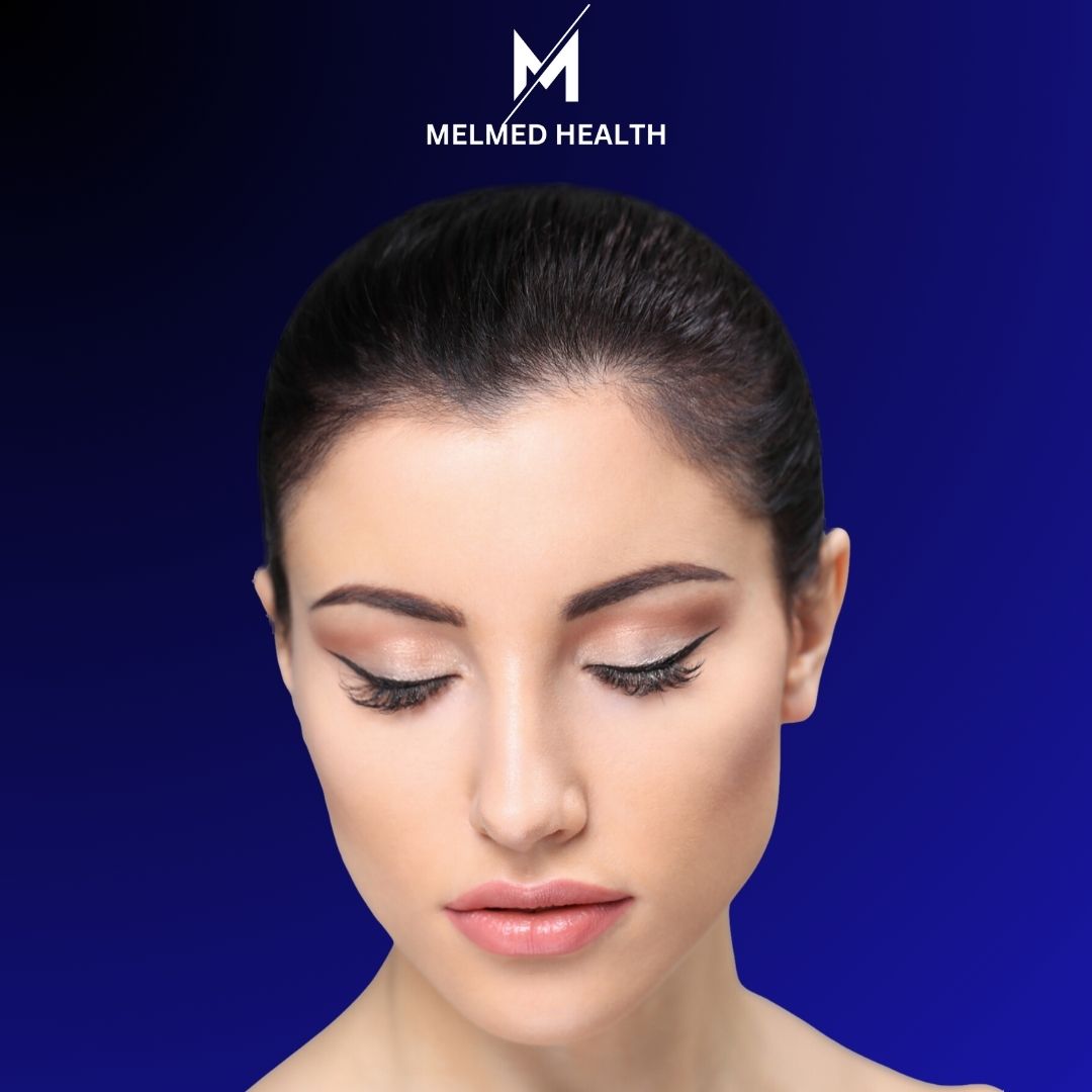 https://melmedhealth.com/wp-content/uploads/2024/02/melmed-BROWS-LIFT.jpg