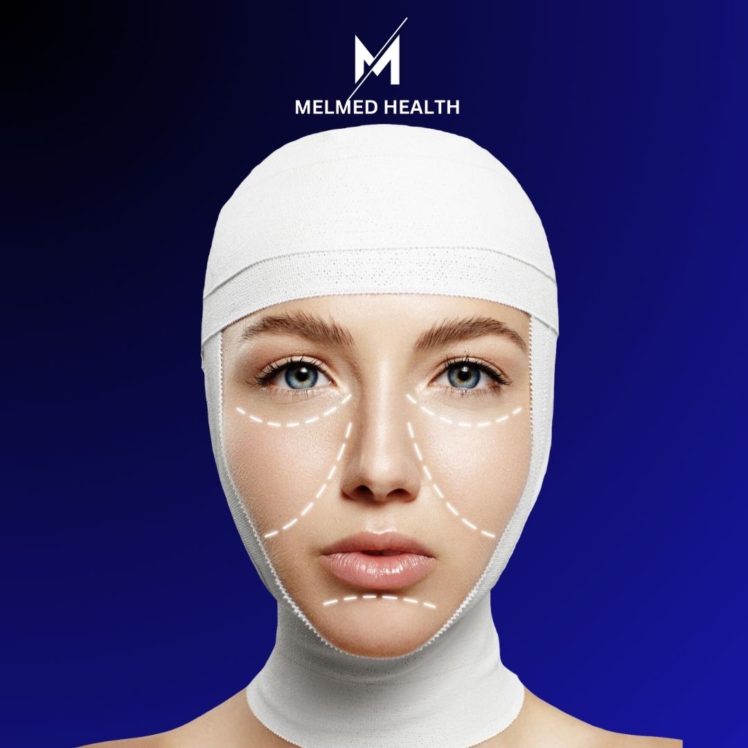 https://melmedhealth.com/wp-content/uploads/2024/02/melmed-FACELIFT-SURGERY.jpg