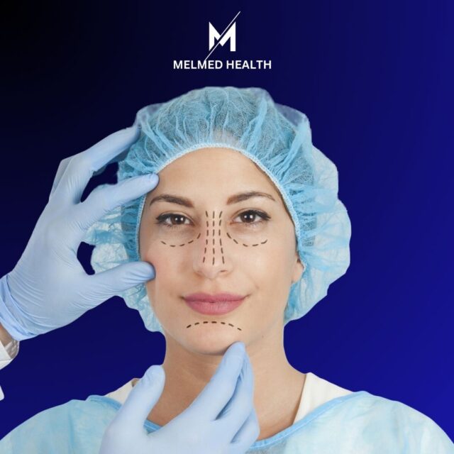 https://melmedhealth.com/wp-content/uploads/2024/02/melmed-f-RHINOPLASTY-1-640x640.jpg