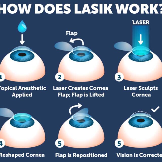 https://melmedhealth.com/wp-content/uploads/2024/03/bodrum-Lasik-Eye-Surgery-640x640.jpeg