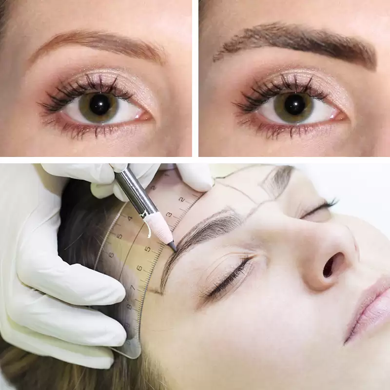 https://melmedhealth.com/wp-content/uploads/2024/03/eyebrow-transplantation.webp